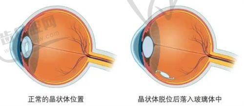 上海安禾美阁聂文婷院长技术优势