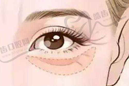 上海安禾美阁聂文婷院长价格表