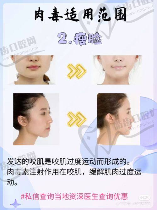 袁杰医生在北京英煌医疗美容的口碑评价及反馈内容