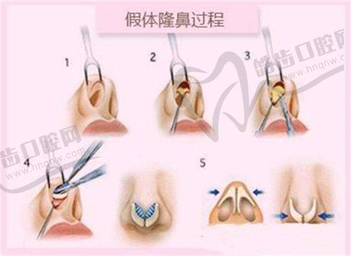 重庆松山整形医院可官网预约——便捷的预约方式等你来体验