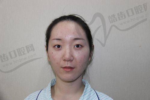 北京嘉禾李燕医生的患者评价与口碑