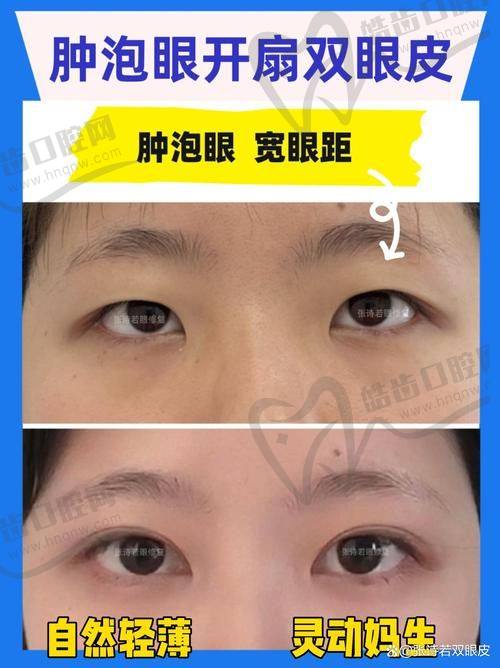 北京嘉禾李燕医生的适用人群