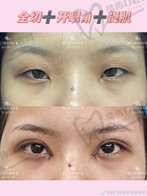 北京嘉禾李燕医生的丰富修复实例