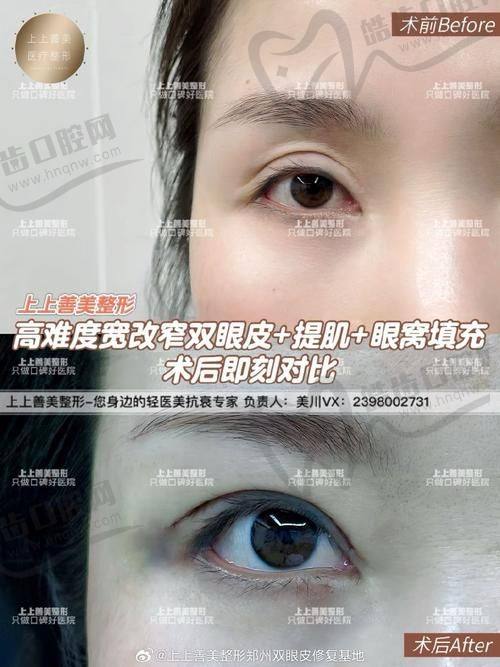 北京嘉禾李燕医生的手术成效体现