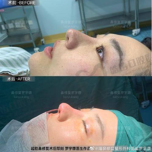这些隐形费用一定要提前算进预算，否则“明亏”
