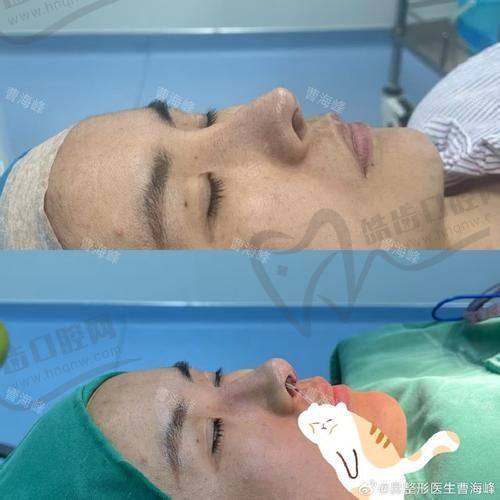 怎么挂李正勇的号？挂号+排期小技巧奉上