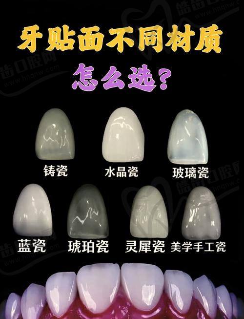 六盘水牙齿贴面医院推荐（附视频实例医院）