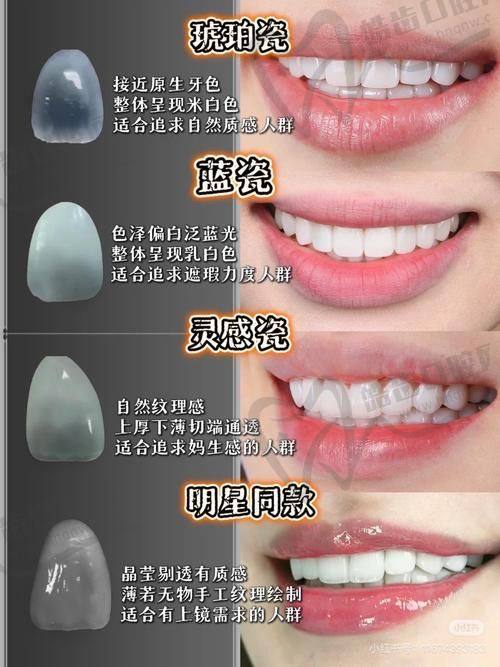 牙齿贴面视频全过程：从设计到完成的6大核心步骤