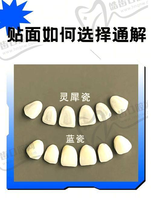 国产爱尔创全瓷牙价格构成：三大核心影响因素