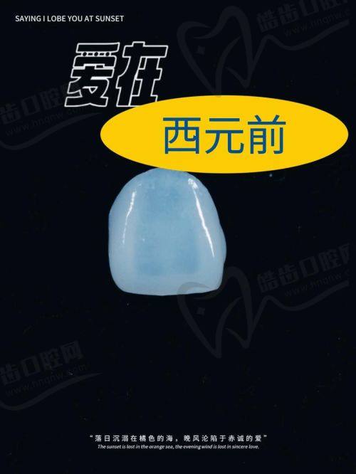 牙齿贴面是否会损害原来牙齿？——材料选择决定损伤程度