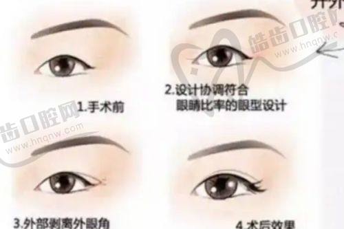 刘祖彪医生的执医荣誉推测