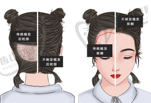 朱晓峰医生坐诊的北京圣爱整形美容医院