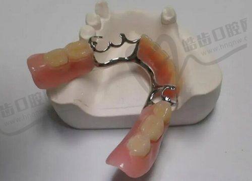余姚三禾口腔没套路之价格合理
