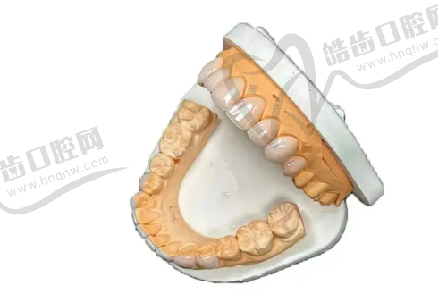 特色项目价格