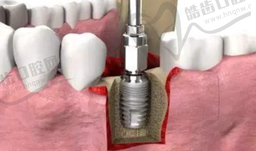五、技术革命：当数字化遇上传统牙科