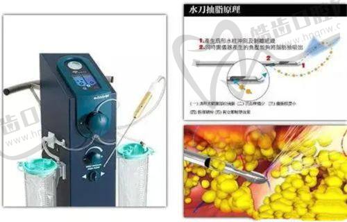 整形医生袁强百家