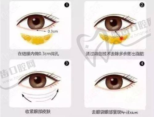 北京圣爱整形美容医院口碑好不好？附真实患者口碑评价