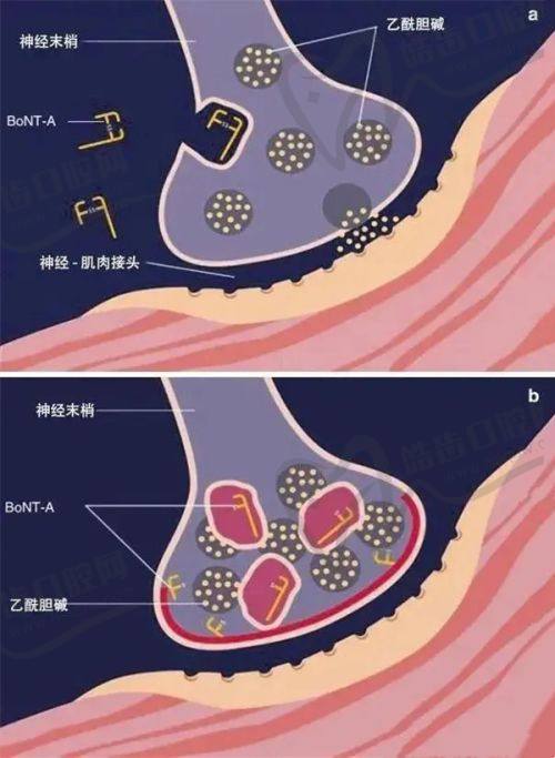 周晚香医生擅长的毛发移植项目