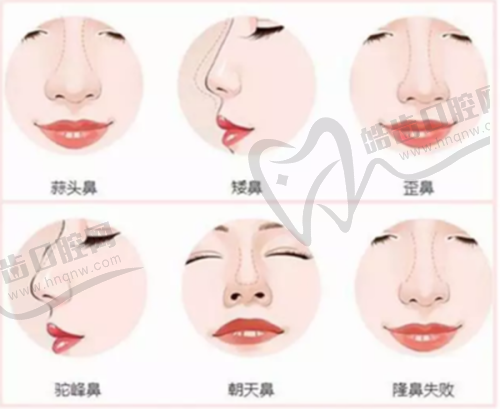 总结