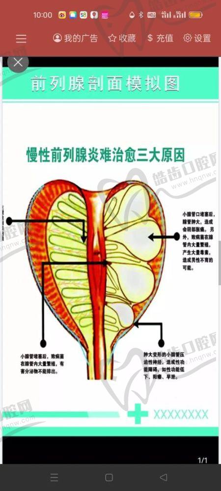 鑲珠兩年后的真實成效參考分析