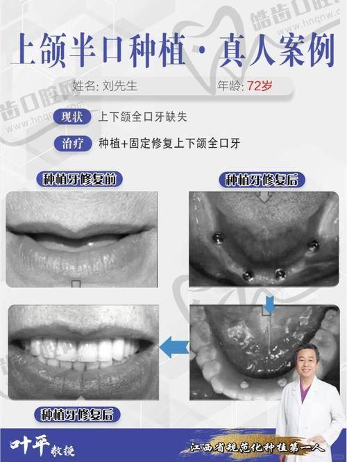 10、佛山种植满口牙医院排名第十：佛山顺德顺齿口腔