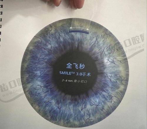 为什么太原爱尔能把价格打下来？从3年数据看降价逻辑