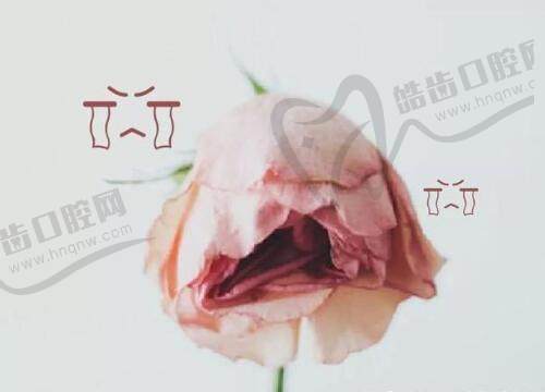 无锡坤如玛丽医院私密整形超靠谱，李文德医生做私密脱毛490元起