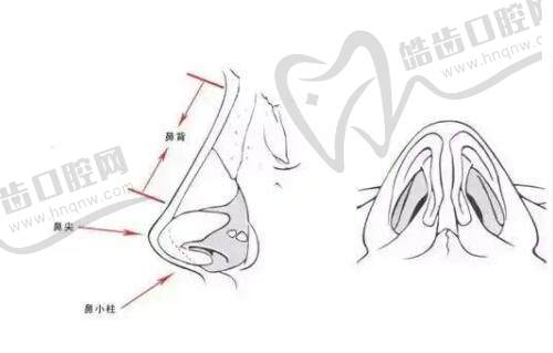 成都成美整形医院冯春雨医生超厉害！鼻骨矫正3.6万起，鼻修复3.2万起 