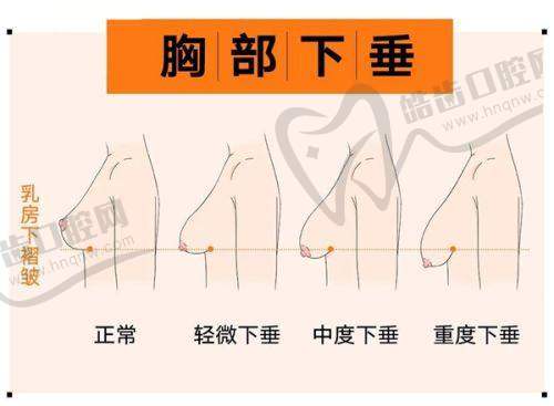 硅胶假耳朵要多少钱？不同城市义耳价格差异