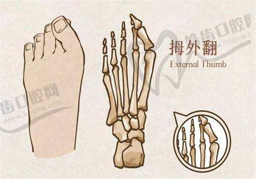 硅胶假耳朵要多少钱？5D仿真义耳价格揭秘
