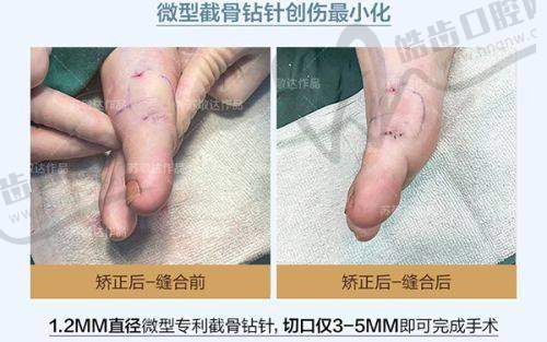 沈阳百嘉丽做双眼皮/隆鼻等项目价格值吗