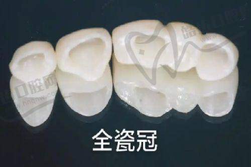 攸县雅贝康口腔门诊部价格表/收费标准2025年