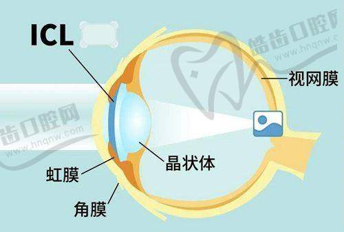 袁州爱瞳眼科门诊部设备仪器