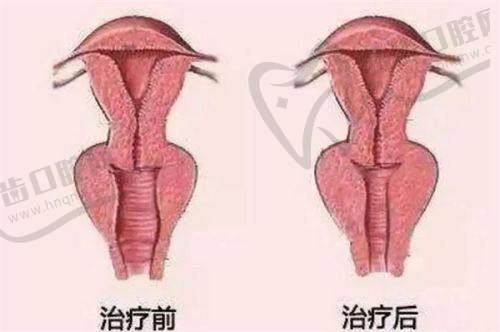 八、唐山工人医院整形科价格表