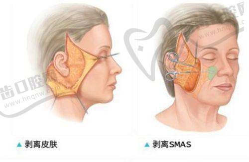 张永新医生的技术优势体现