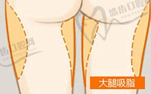 八爪鱼紧缩术多少钱：顾客反馈与价格的关联