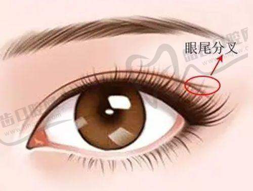 杨军 医生擅长的美容整形项目