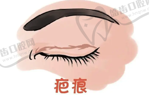 杨军 医生的口碑评价及反馈实例