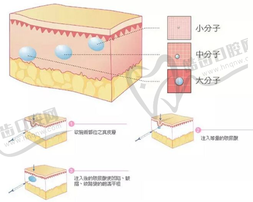 沈阳名流王莉莉做双眼皮收费：性价比高，没有隐形消费