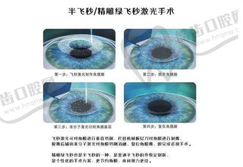 袁州爱尔眼科门诊部口碑如何
