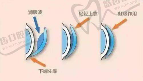 袁州爱尔眼科门诊部地址