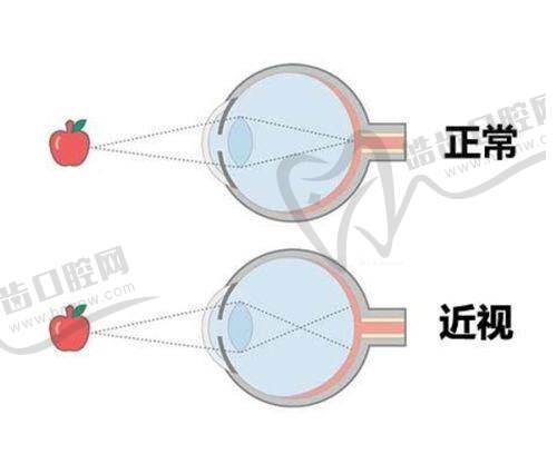 北京爱尔英智眼科医院彭晓燕怎么样：看个人履历、专业技术、费用明细全揭秘，线上可预约到院哦