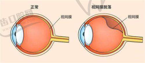 袁州爱瞳眼科门诊部特色技术