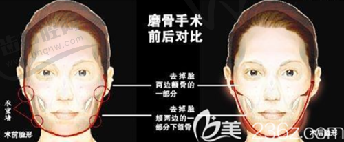 唐山美尚医疗美容医院口碑好不好？附真实患者口碑评价