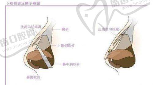 三、唐山工人医院整形科怎么样，口碑评价如何？