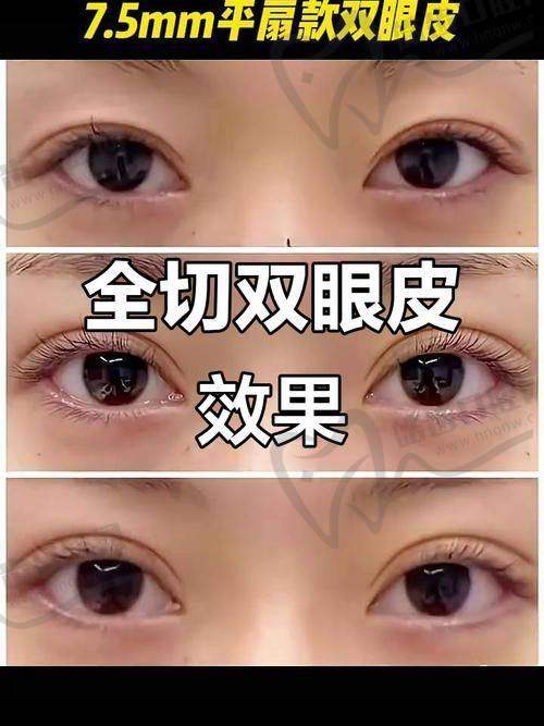 预约挂号方式