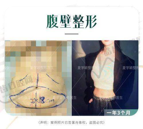 那李献和医生适合谁？