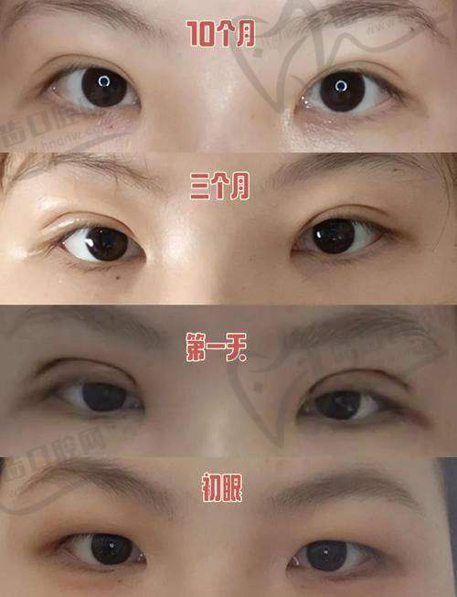 五、术后跟进全流程，她可不是做完就“拜拜”那种