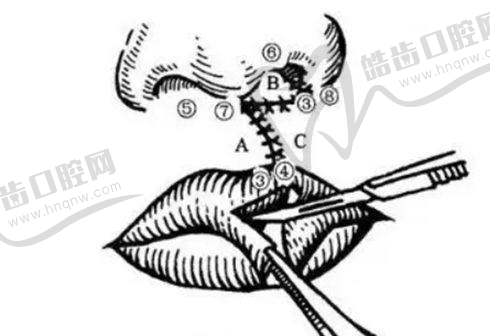 昆明海木医疗美容门诊部口碑好不好？附真实患者口碑评价