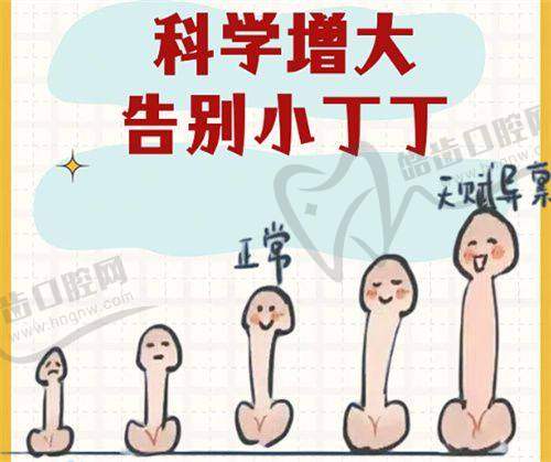 傲诺拉假体和曼托假体区别在哪之自然度表现